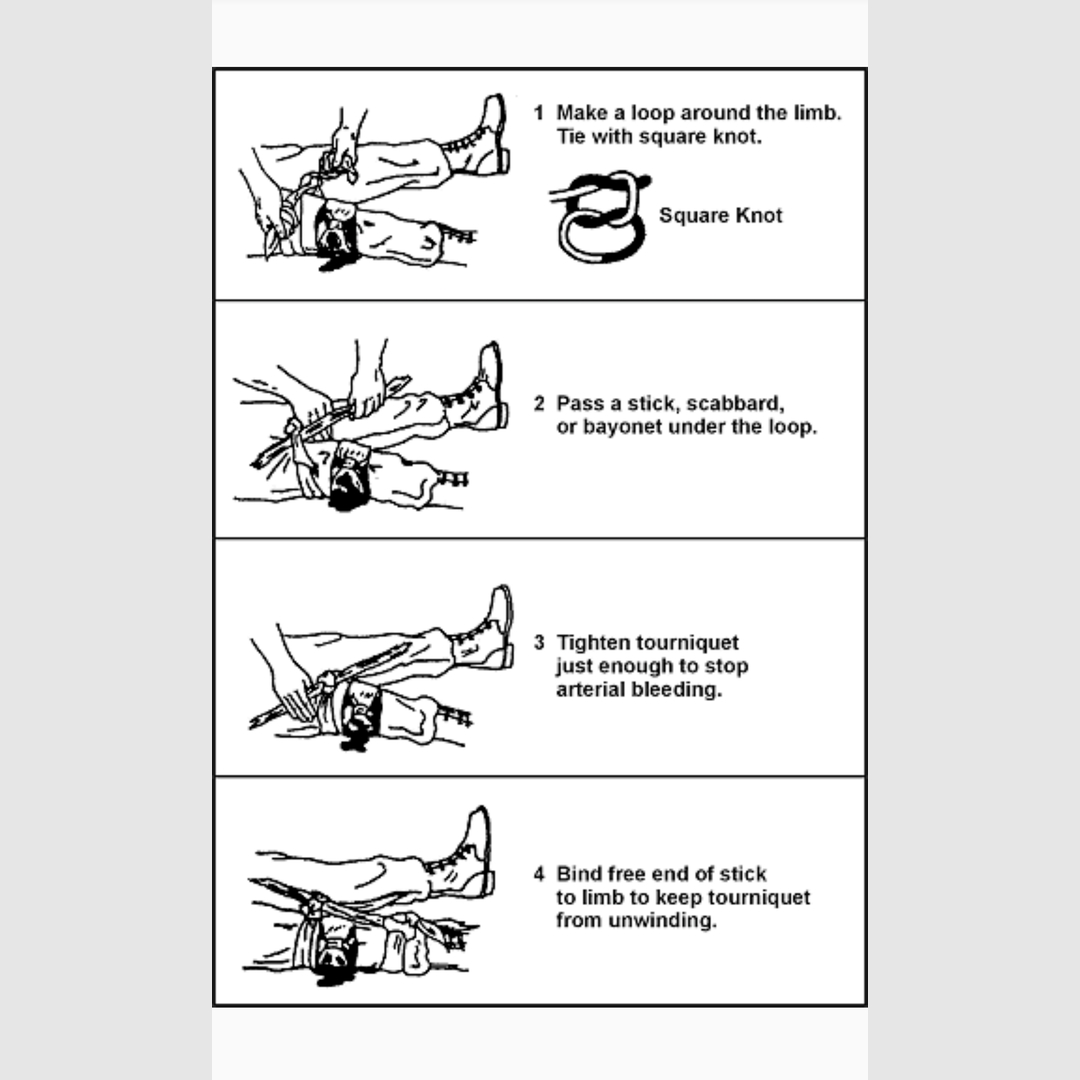 How to tie a tourniquet in a survival situation