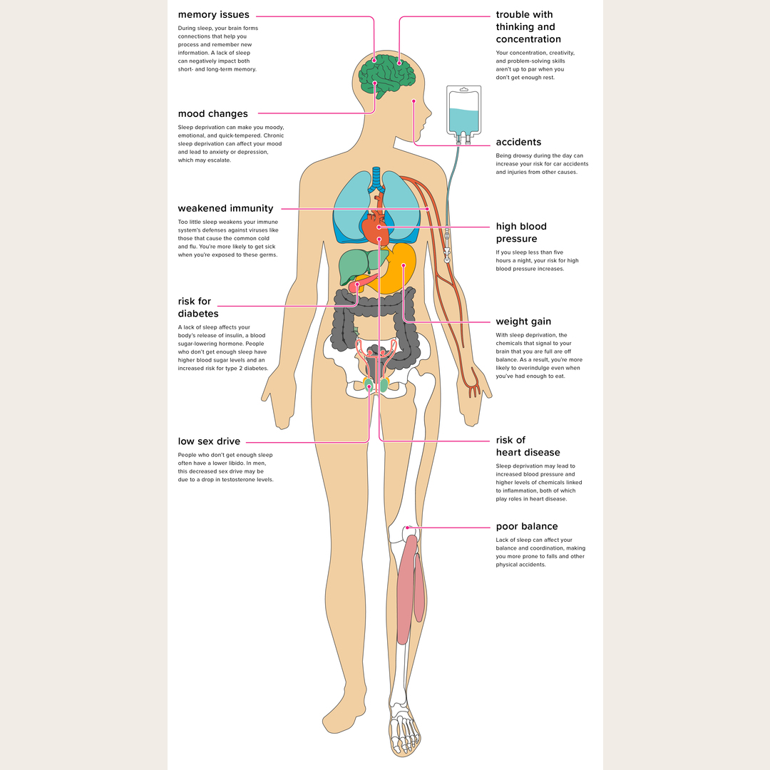 The effects of sleep deprivation on the human body